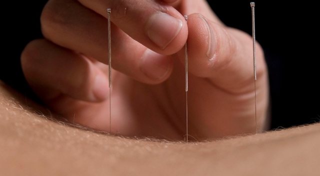acupuncture in dubai
